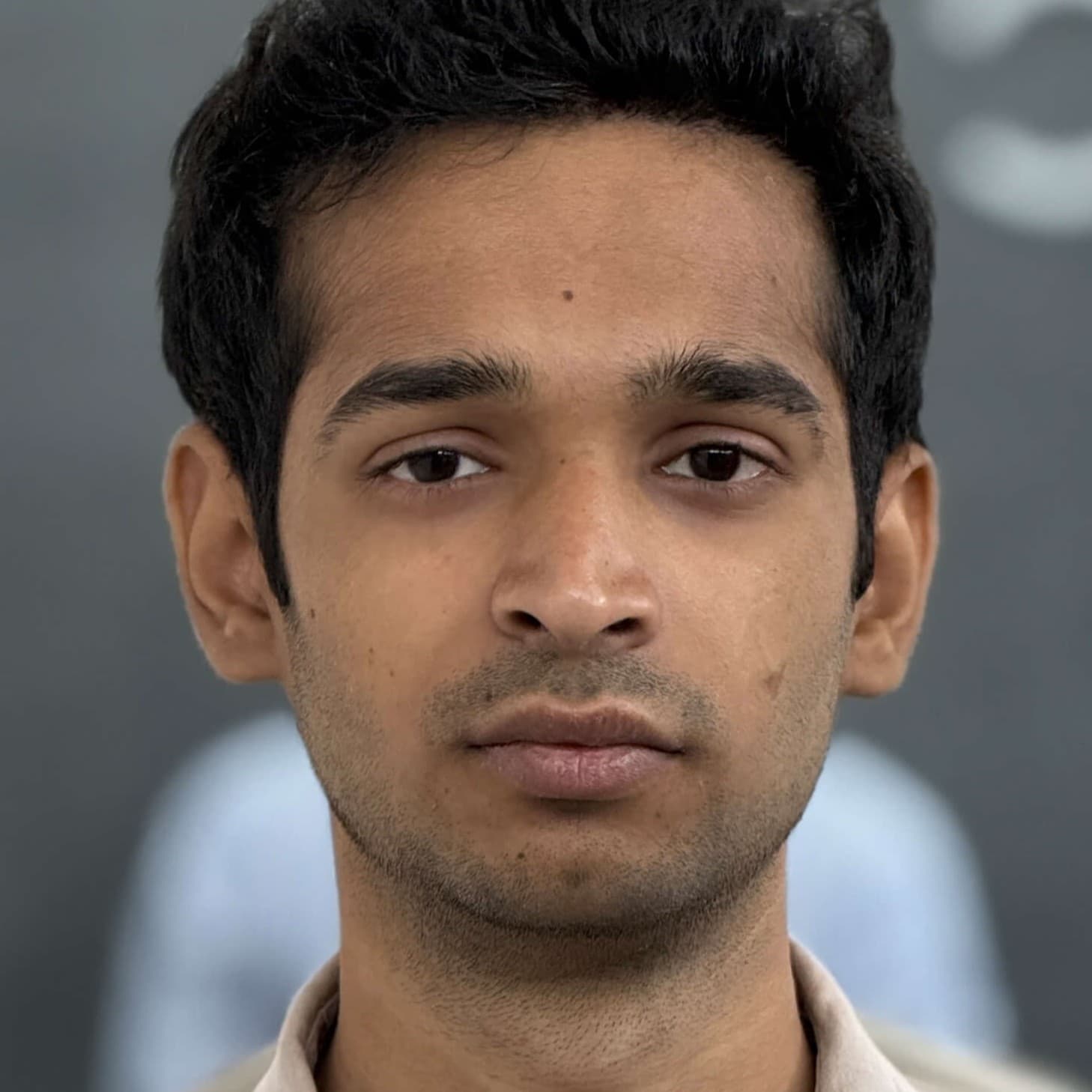 Hair transplant result 10