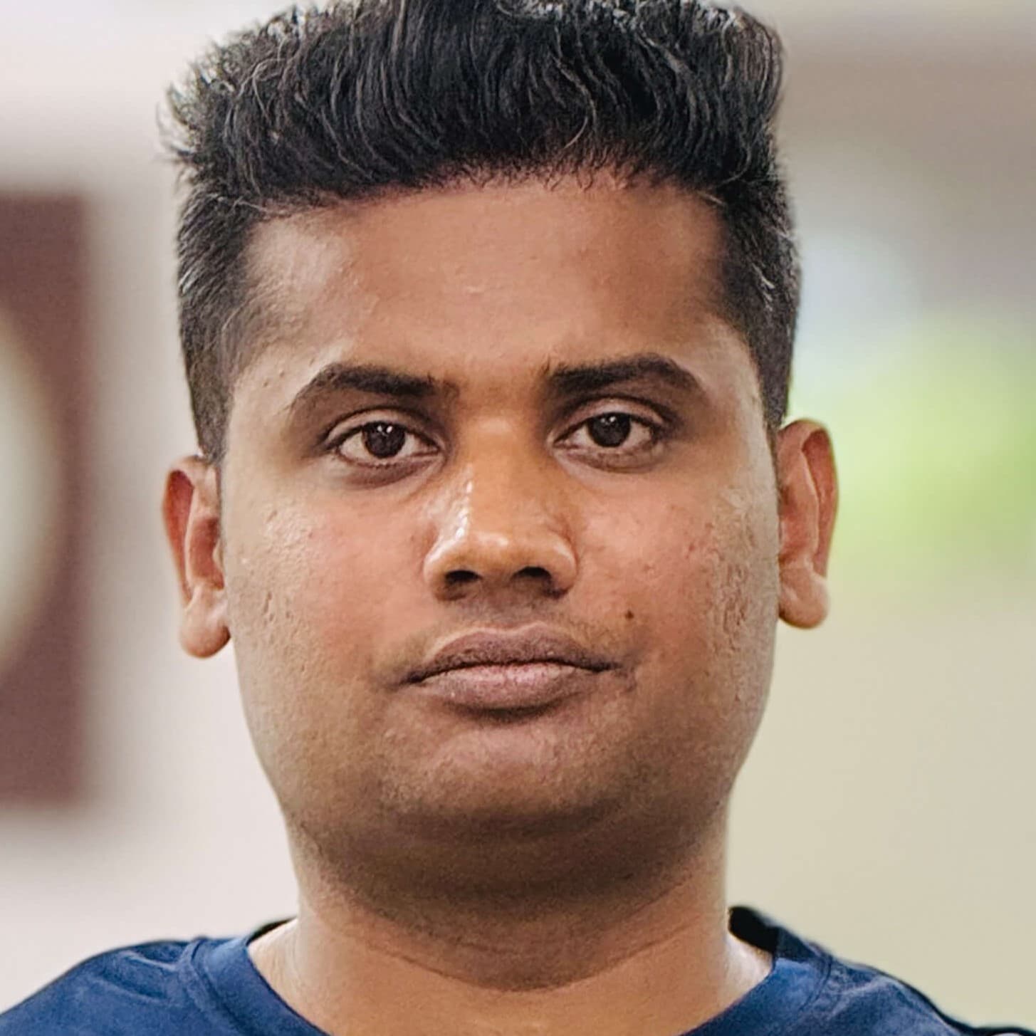 Hair transplant result 15