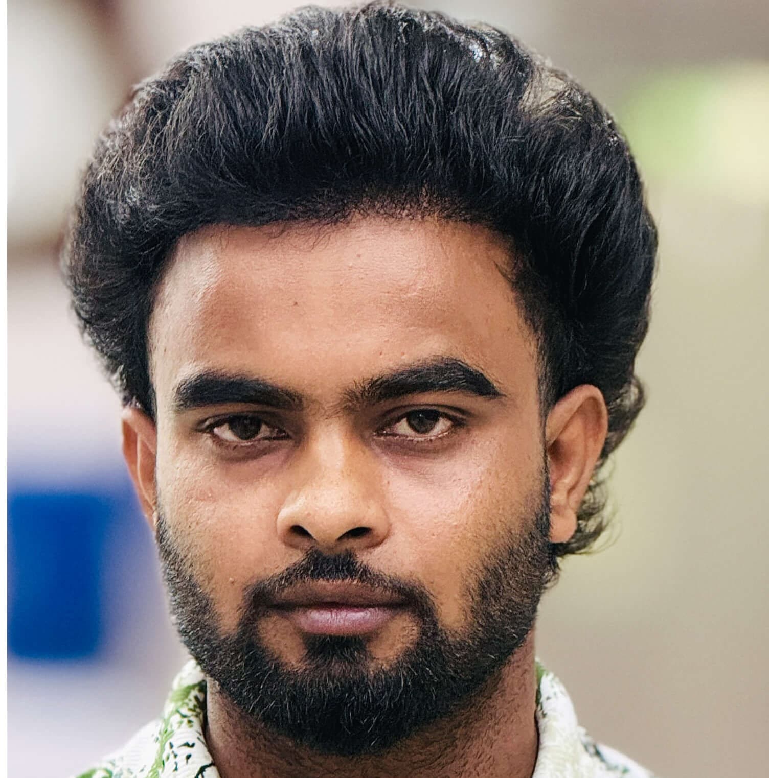 Hair transplant result 16
