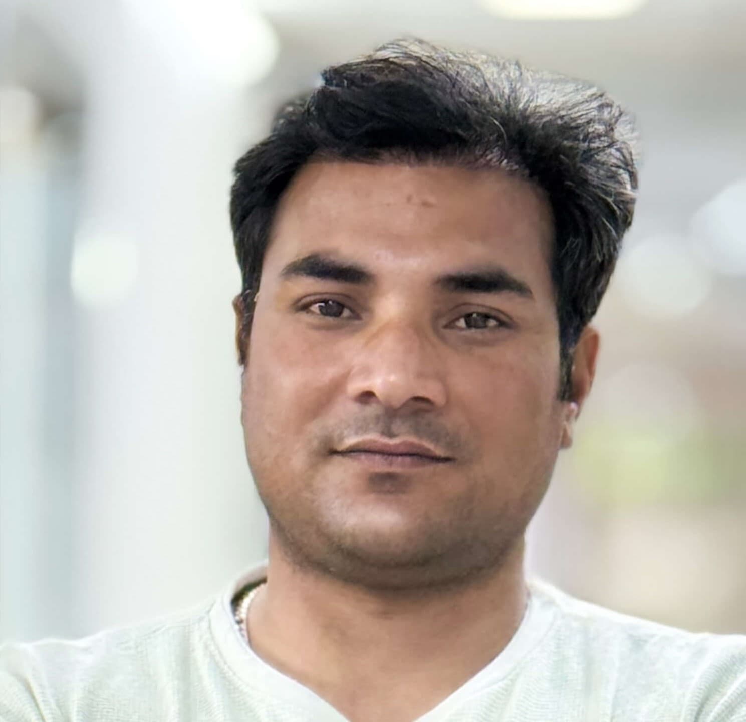 Hair transplant result 2